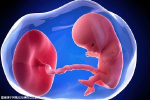 体外受精 IVF-ET